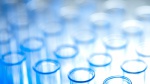 2013 testing reports from Anti-Doping Organisations with focus on FIS Disciplines